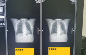 团伙式作案、全链条造假、恶意对抗调查 国家医保局通报无锡虹桥医院调查情况