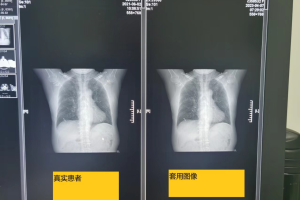 团伙式作案、全链条造假、恶意对抗调查 国家医保局通报无锡虹桥医院调查情况